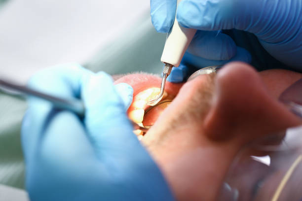 Best Broken or Cracked Tooth Emergency Dentist in West Union, IA
